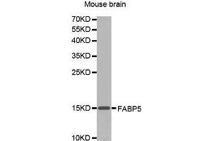 Western Blotting (WB) image for anti-Fatty Acid Binding Protein 5 (Psoriasis-Associated) (FABP5) (AA 1-100) antibody (ABIN1679794) (FABP5 antibody  (AA 1-100))