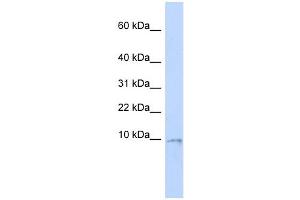 UCRC antibody used at 1 ug/ml to detect target protein.