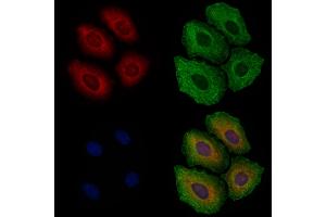 ABIN6262313 and ABIN6277241 staining Hela cells by IF/ICC.