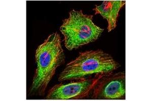 Immunofluorescence (IF) image for anti-Glypican 3 (GPC3) antibody (ABIN1107403) (Glypican 3 antibody)