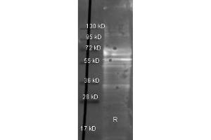 Western Blotting (WB) image for anti-Fibrinogen antibody (ABIN1607626) (Fibrinogen antibody)