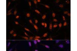 Immunofluorescence analysis of NIH/3T3 cells using Twist Polyclonal Antibody at dilution of 1:100. (TWIST1 antibody)