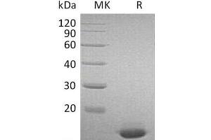 Western Blotting (WB) image for Interferon, alpha 2 (IFNA2) protein (ABIN7320562) (IFNA2 Protein)