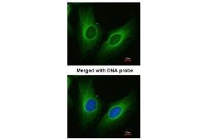 ICC/IF Image Immunofluorescence analysis of paraformaldehyde-fixed HeLa, using AKR1C3, antibody at 1:200 dilution. (AKR1C3 antibody  (C-Term))