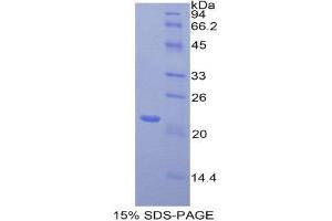 SDS-PAGE (SDS) image for Toll-Like Receptor 3 (TLR3) (AA 533-705) protein (His tag) (ABIN2122244) (TLR3 Protein (AA 533-705) (His tag))