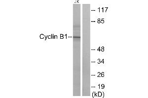 Western blot analysis of extracts from Jurkat cells, treated with UV (15mins), using Cyclin B1 (Ab-147) antibody. (Cyclin B1 antibody  (Ser147))