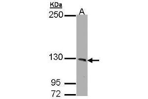 WB Image Sample (30 ug of whole cell lysate) A: HeLa 7. (PHKA1 antibody  (C-Term))