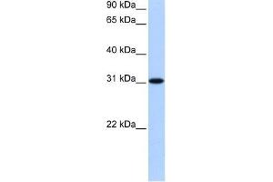 TNRC18 antibody used at 0.