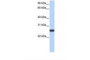 Image no. 1 for anti-Transmembrane Protease, serine 5 (TMPRSS5) (AA 270-319) antibody (ABIN6739260)