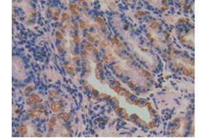 IHC-P analysis of Human Stomach Tissue, with DAB staining. (SERPINA7 antibody  (AA 128-415))