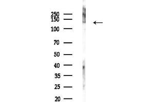 Western blot analysis of lysates from COLO205 cells(UV,30 min treatment), using SAP130 Antibody at 1/1000 dilution.