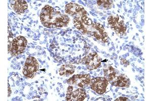 ZNF409 antibody was used for immunohistochemistry at a concentration of 4-8 ug/ml to stain Epithelial cells of renal tubule (arrows) in Human Kidney.