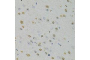 Immunohistochemistry of paraffin-embedded mouse brain using HNRNPD Antibody. (HNRNPD/AUF1 antibody  (AA 1-306))