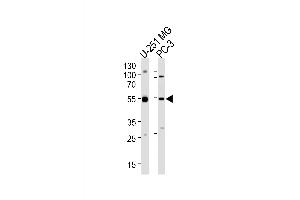Western blot analysis of lysates from U-251 MG, PC-3 cell line (from left to right), using DEK Antibody (C-term) (ABIN653133 and ABIN2842710). (DEK antibody  (C-Term))