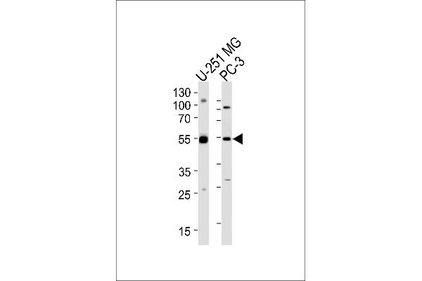 DEK antibody  (C-Term)