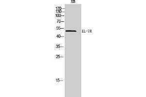 Western Blotting (WB) image for anti-Interleukin 7 Receptor (IL7R) (Internal Region) antibody (ABIN3181445) (IL7R antibody  (Internal Region))