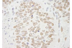 Immunohistochemistry (IHC) image for anti-Protein Arginine Methyltransferase 6 (PRMT6) (C-Term) antibody (ABIN7448744)