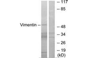Western blot analysis of extracts from 293 cells, treated with EGF 200ng/ml 30', using Vimentin (Ab-83) Antibody. (Vimentin antibody  (AA 56-105))