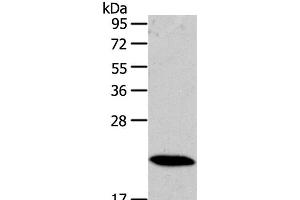 Western Blot analysis of Mouse heart tissue using RAB18 Polyclonal Antibody at dilution of 1:400 (RAB18 antibody)