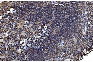 IHC analysis of OTULIN using anti-OTULIN antibody (ABIN7601854). (FAM105B antibody  (AA 49-352))