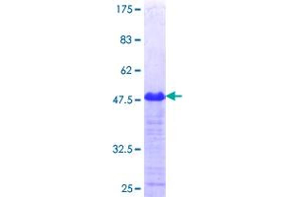 HIPK4 Protein (AA 519-616) (GST tag)
