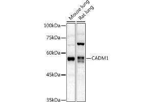 Western blot analysis of extracts of various cell lines, using C antibody (ABIN3022654, ABIN3022655, ABIN3022656 and ABIN6219028) at 1:1000 dilution. (CADM1 antibody  (AA 45-344))