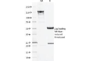 SDS-PAGE Analysis Purified CD10 Mouse Monoclonal Antibody (MME/1893). (MME antibody  (AA 297-483))