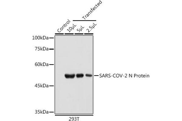 SARS-CoV-2 Nucleocapsid antibody