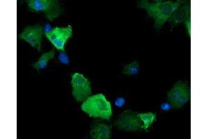 Image no. 3 for anti-Cancer/testis Antigen 1B (CTAG1B) antibody (ABIN1499897) (CTAG1B antibody)
