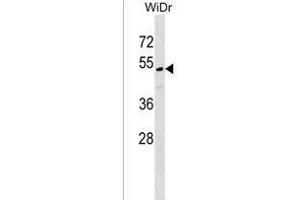 MLF1IP Antibody (C-term) (ABIN1537070 and ABIN2849045) western blot analysis in WiDr cell line lysates (35 μg/lane).