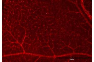 Immunofluorescence (IF) image for anti-Red Fluorescent Protein (RFP) antibody (ABIN129578)