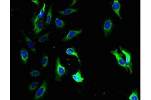 Immunofluorescent analysis of Hela cells using ABIN7154031 at dilution of 1:100 and Alexa Fluor 488-congugated AffiniPure Goat Anti-Rabbit IgG(H+L) (QPCTL antibody  (AA 212-382))