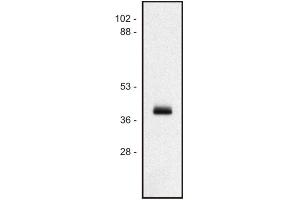 MICA antibody