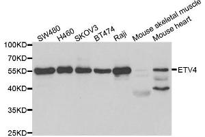 Western blot analysis of extracts of various cell lines, using ETV4 antibody. (ETV4 antibody)