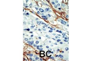 Immunohistochemistry (IHC) image for anti-NUAK Family, SNF1-Like Kinase, 1 (NUAK1) antibody (ABIN2908464)