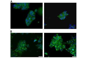 Immunocytochemistry staining of HepG2 cells (Panel A) and MCF-7 (Panel B) with Estrogen receptor alpha monoclonal antibody (C-542)  at 10μg/ml. (Estrogen Receptor alpha antibody  (C-Term))