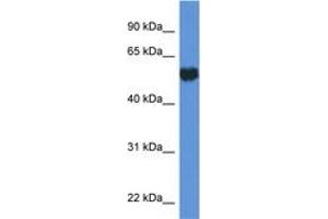 Image no. 1 for anti-Glucose-6-Phosphate Isomerase (GPI) (C-Term) antibody (ABIN6746935) (GPI antibody  (C-Term))