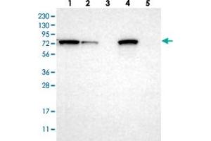 Western blot analysis of Lane 1: RT-4, Lane 2: U-251 MG, Lane 3: Human Plasma, Lane 4: Liver, Lane 5: Tonsil with HADHA polyclonal antibody  at 1:250-1:500 dilution. (HADHA antibody)