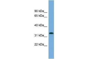 WB Suggested Anti-IFI35 Antibody Titration:  0. (IFI35 antibody  (N-Term))