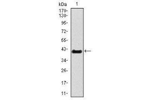 Image no. 1 for anti-T Brachyury Protein antibody (ABIN1491210)