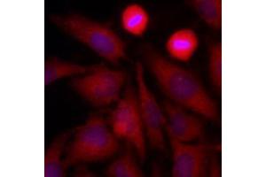 Immunofluorescence of human HeLa cells stained with Hoechst 3342 (Blue) for nucleus staining and monoclonal anti-human GAPDH antibody (1:500) with Texas Red (Red). (GAPDH antibody  (AA 1-335))