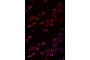 Immunofluorescence analysis of U2OS cells using NRBF2 antibody (ABIN5973861). (NRBF2 antibody)