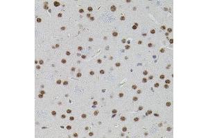 Immunohistochemistry of paraffin-embedded mouse brain using SMAD5 antibody (ABIN1874856) (40x lens).