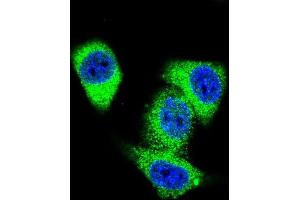 Confocal immunofluorescent analysis of TOP2A Antibody (C-term) with Hela cell followed by Alexa Fluor 488-conjugated goat anti-rabbit lgG (green). (Topoisomerase II alpha antibody  (C-Term))