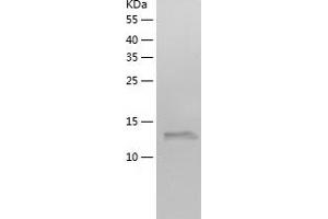 C7orf49 Protein (AA 1-157) (His tag)