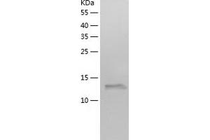Western Blotting (WB) image for Chromosome 7 Open Reading Frame 49 (C7ORF49) (AA 1-157) protein (His tag) (ABIN7122394) (C7orf49 Protein (AA 1-157) (His tag))