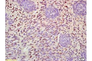 Formalin-fixed and paraffin embedded mouse embryo labeled with Anti-MSX1 Polyclonal Antibody, Unconjugated (ABIN1385926) at 1:200 followed by conjugation to the secondary antibody and DAB staining (MSX1 antibody  (AA 151-297))