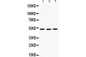 Western blot analysis of Cdc25C expression in HELA whole cell lysates (lane 1), SW620 whole cell lysates (lane 2) and MCF-7 whole cell lysates (lane 3). (CDC25C antibody  (C-Term))