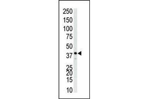 The anti-P38 Pab (ABIN1882176 and ABIN2841644) is used in Western blot to detect P38 in Jurkat cell lysate.