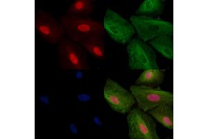 ABIN6257756 and ABIN6273652 staining  cells by IF/ICC. (IL16 antibody  (C-Term))